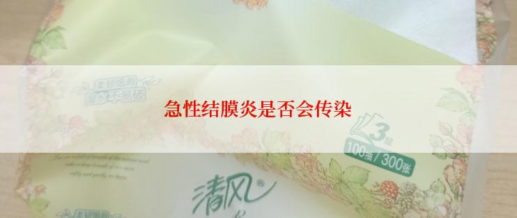 急性结膜炎是否会传染